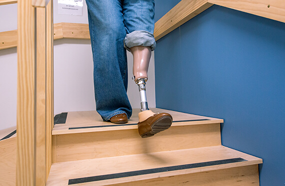 Close up of a person with a prosthetic leg walking down a set of stairs